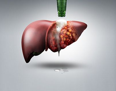 Liver_Cancer_Visual_Design_-_Ramone_V.jpg